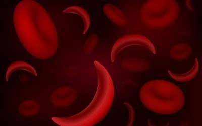 Spotlight on Sickle Cell Disease:  September is Sickle Cell Disease Awareness Month
